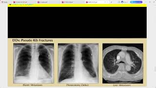 RADIOLOGY EXAM CASES [upl. by Ulda170]