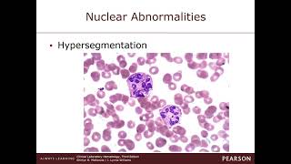 Chapter 21 Nonmalignant disorders of Granulocytes and Monocytes [upl. by Parnas]