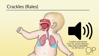 Respiratory Assessment by B Leary L DelSignore  OPENPediatrics [upl. by Rains541]