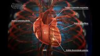 Angioplastia Coronária  Ultrassom  Hospital Cardiológico Costantini [upl. by Kelci]