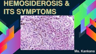 What are Hemosiderosis and its symptoms Biotechnology  General Medicine [upl. by Eissalc]