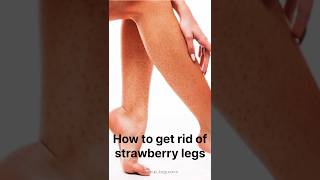 Get rid of strawberry legs skincaretips begusarai beautyhacks legs glowuptips [upl. by Asseralc674]