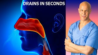 Dr Mandells Sinus Drainage Trick [upl. by Aelber]