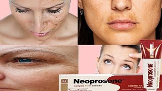 Neoprosone skin brightening cream reviewshmcorner [upl. by Leahpar390]