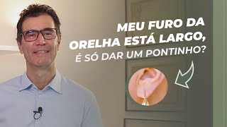 O furo da sua orelha está largo Saiba o que fazer [upl. by Wolfe]