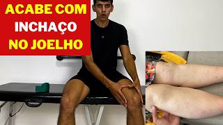 EXERCÍCIOS PARA INCHAÇO NO JOELHO [upl. by Dnalon689]