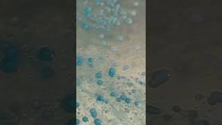 Candida albican on candida deferential agar plate  Day 1 of Biotechnology lab video [upl. by Llertnauq]