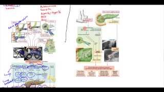 Acute Pancreatitis Chronic Pancreatitis Psuedocyst Adenocarcinoma [upl. by Annmaria]