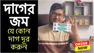 Mederma Scar Removal Gel  সার্জারির দাগ দ্রুতগতিতে দূর করে যে ক্রিম  Advanced Mederma Plush [upl. by Sinylg877]