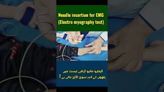 EMG Needle Insertion A Patients Guide  What to Expect [upl. by Vidovic]