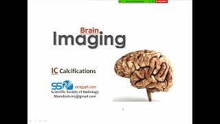 13 Intracranial Calcification imaging  Prof Mamdouh Mahfouz [upl. by Limann]