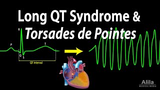 Long QT Syndrome and Torsades de Pointes Animation [upl. by Maggs]