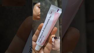 glocin gel review If you have any doubts of glocin gel check this clindamycin amp nicotinamide gel [upl. by Ahtelat219]