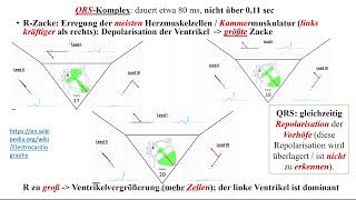 Herz 10 EKG 3  QRS Komplex T Welle und U Welle [upl. by Mallissa]