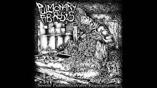 Pulmonary Fibrosis – Severe Pulmonic Valve Regurgitation EP 2021  Goregrind [upl. by Lipscomb913]