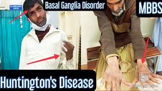 Huntingtons Chorea Neurodegenerative disease of Basal Ganglia [upl. by Gayla]