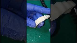 Shaping interdental papilla and gums for g cam bridge before Bredent gum layering [upl. by Ellivnarg]