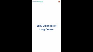 Early Diagnosis of Lung Cancer  Dr Vasunethra Kasargod  Manipal Hospital Millers Road [upl. by Dnalevelc]