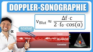 DopplerSonographie Blutfließgeschwindigkeit [upl. by Charmaine]