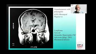 ESO Guideline Webinar on PACNS amp SVD Part 2 [upl. by Yrekaz]