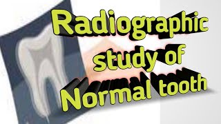 Radiographic study of normal tooth  Radiopaque and Radiolucent Basic of radiograph of tooth struc [upl. by Ecerahc]