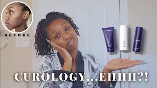 I Tried Curology For 30 Days amp This Happened Honest Review Hormonal Acne  Blemishes [upl. by Atinehc]