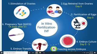 In vitro fertilization IVF and embryo transfer [upl. by Skyla]