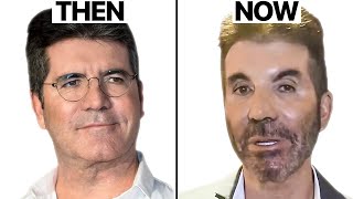 Simon Cowell NEW FACE  Plastic Surgery Analysis [upl. by Farro]