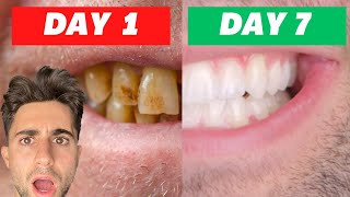 I Tried Crest Whitening Strips For 7 Days INSANE RESULTS Honest Review [upl. by Spiers]