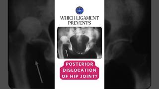 Which ligament prevents the posterior dislocation of hip joint shorts hipjoint ligaments [upl. by Folger]