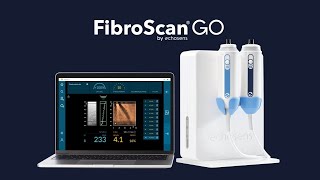 Discover FibroScan® GO The stateoftheart noninvasive solution affordable to all [upl. by Gwynne]