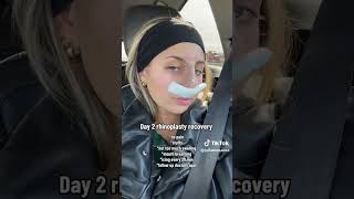 Day 2 Rhinoplasty Recovery nosejob recoveryaftersurgery rhinoplastysurgeon rhinoplastyresults [upl. by Louella]