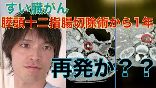 【がん】すい臓がんから1年たったが再発か！？がん 膵頭十二指腸切除術抗がん剤 [upl. by Bettye]