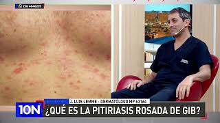 ¿Qué es la pitiriasis rosada de gib [upl. by Croner528]