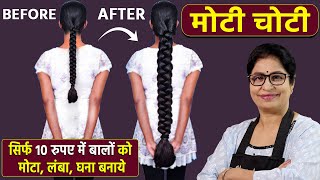 रूखे सूखे बेजान बालों में भी डाल देगा एक नई जान  100 नए बाल उगाएँ  DIY Powerful Hair Growth Serum [upl. by Eentirb583]