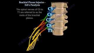 Brachial Plexus Injuries Erbs Paralysis  Everything You Need To Know  Dr Nabil Ebraheim [upl. by Reddin122]