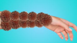 ASMR Treatment Animation from Infected Hand  Remove Ticks amp Worm Infection  ASMR 2d Animation [upl. by Acirre]