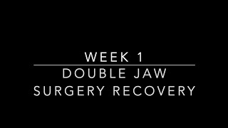 DOUBLE JAW SURGERY RECOVERY WEEK 1  Lefort 1 Osteotomy Bilateral Sagittal Split Osteotomy [upl. by Kcirad398]