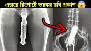 এইসব ব্যক্তির X Ray ছবি দেখে ডাক্তারও অজ্ঞান হয়ে গেছে 😱 একবার দেখলে জীবন ধন্য [upl. by Itsirhc]