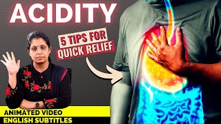 Animation How to treat Acid Reflux  நெஞ்செரிச்சல் குணமாக இதை செய்யுங்கள் [upl. by Aikas]