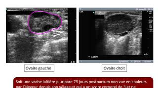 Video echographie vache anoestrus pathologique detection [upl. by Lawrence]