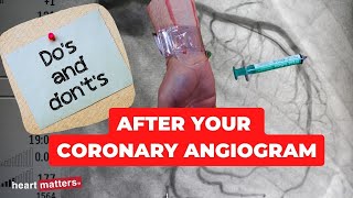 Post your coronary angiogram  What to know [upl. by Alberic]