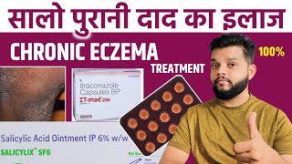 सालों पुराने दाद का सम्पूर्ण इलाज  Chronic Eczema Allopathic Treatment In Hindi  Fungal Infection [upl. by Annaesor]