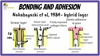 Enamel and Dentin Bonding Made SUPER EASY  Dental Materials [upl. by Schoening]