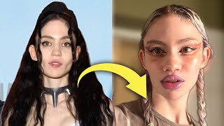 Grimes Admits to Plastic Surgery Is this the Start of the New Transparency Era [upl. by Redlac]