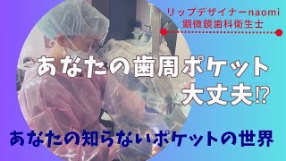 第２弾！あなたの歯周ポケット大丈夫！？治療歯の歯石除去編！歯周病は沈黙の病気です。費用をかけた治療歯もメインテナンスが必要です。20231020 [upl. by Llorrac]