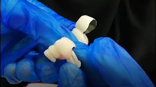 Glass Abutment Dental Bridge Impression Technique [upl. by Colan]