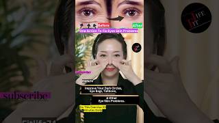 One Action To Fix Eyes Skin Problems eyelift eyeexercise yoga faceyoga facialyoga shorts [upl. by Zetroc]