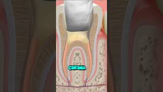 con la endodoncia no puede comer dientes dentista tips parati viral fyp shorts shortvideo [upl. by Ylro583]