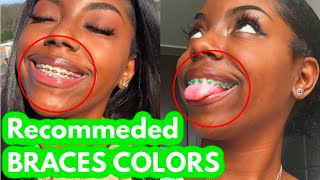 Choose THESE COLORS on your next braces appointment [upl. by Ledua]